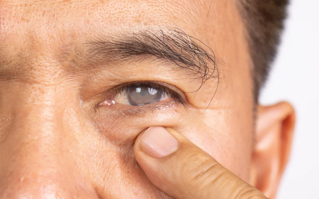 How to Recognize the Early Signs of Glaucoma 